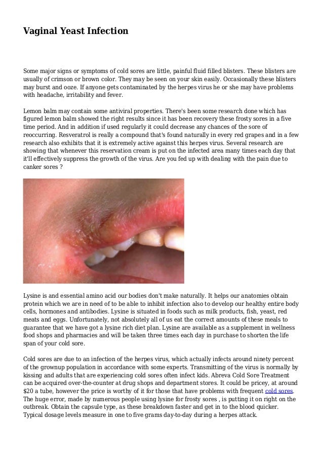 vaginal yeast infection sores Running partner sex